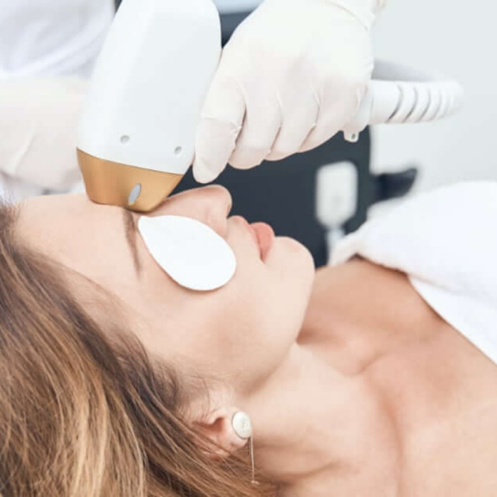 Diodo Laser (Cara Completa) at Diana Bella LLC in Deerfield Beach, FL