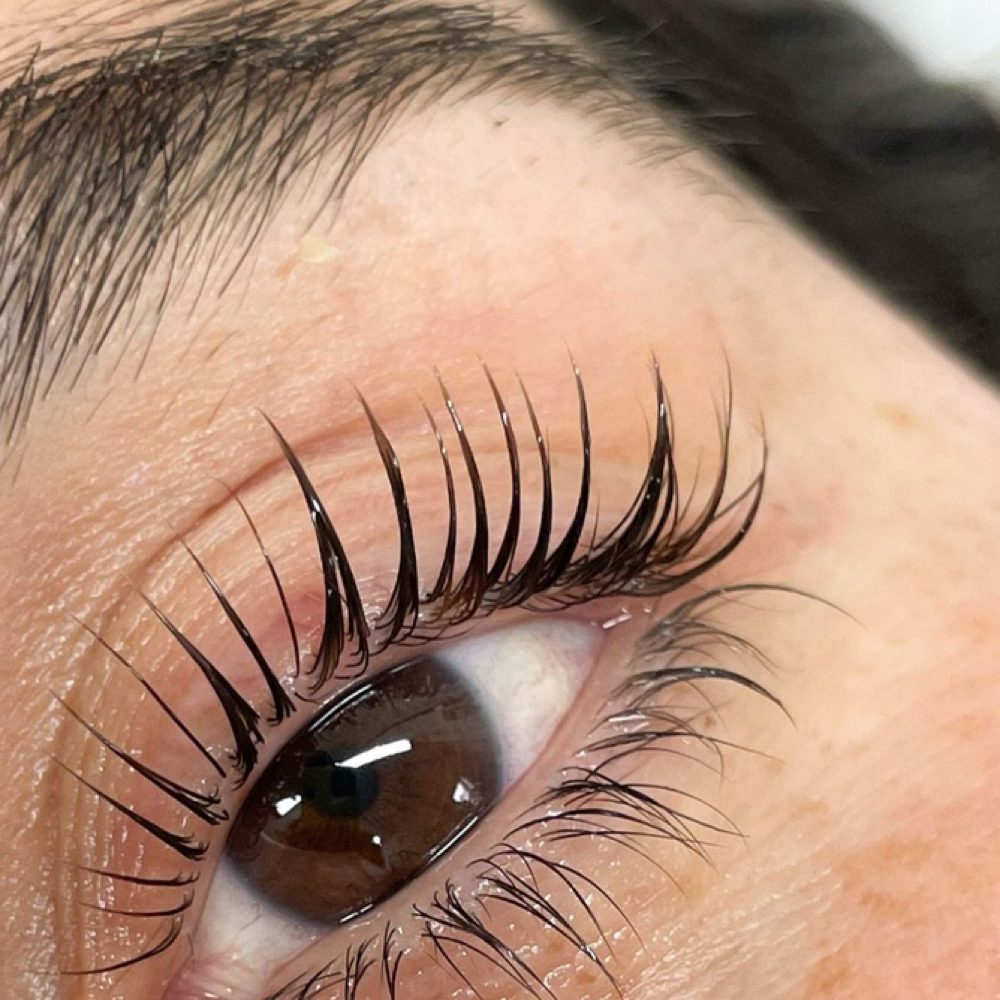 korean lift kit at by grace esthetics in Florence, AL