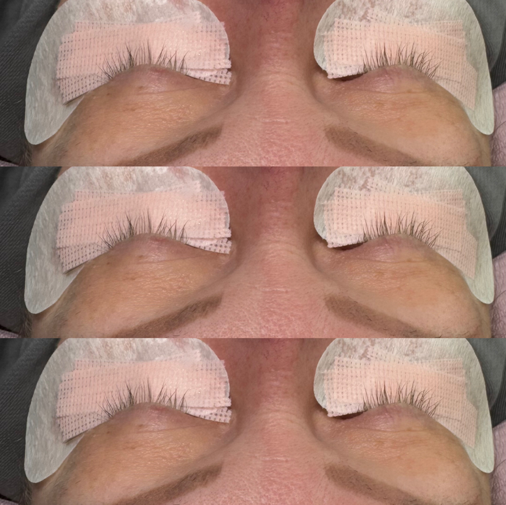 Lash Removal