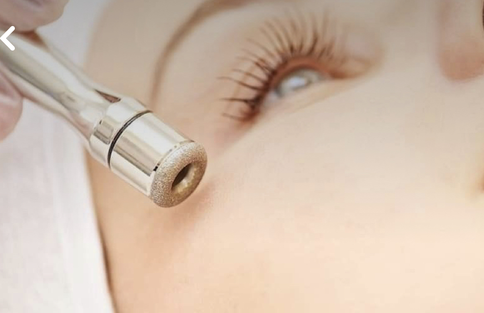 Microdermabrasion + Enzyme Or LED