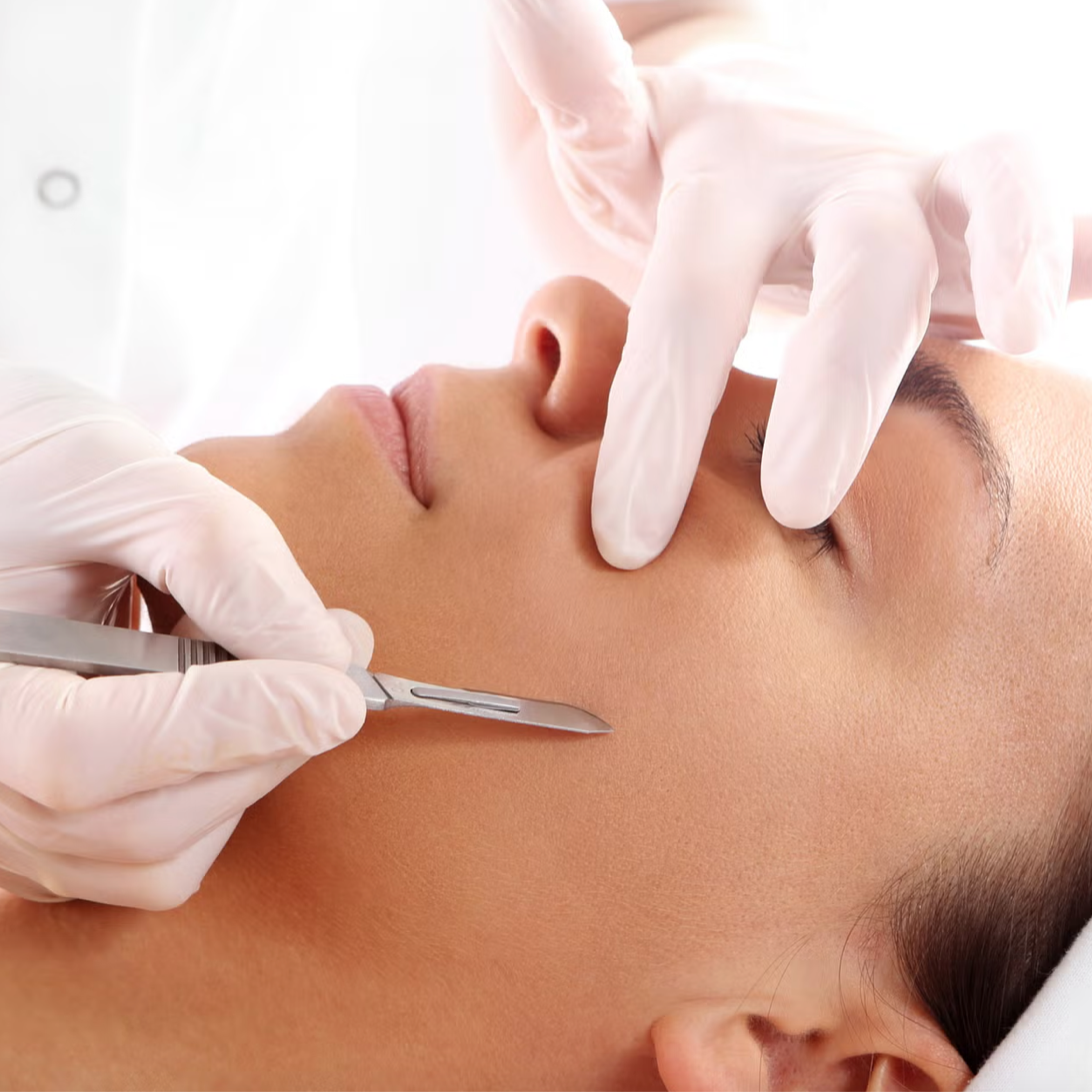Add-On Dermaplaining at Rose & Balance Skin Studio in San Diego, CA