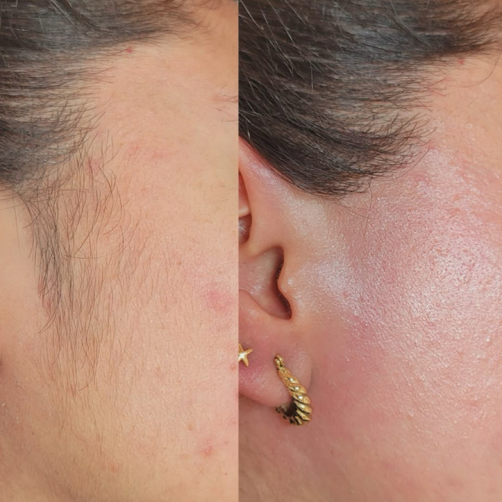 Lip + Chin + Sideburn Wax at Making.you.confident in Muleshoe, TX