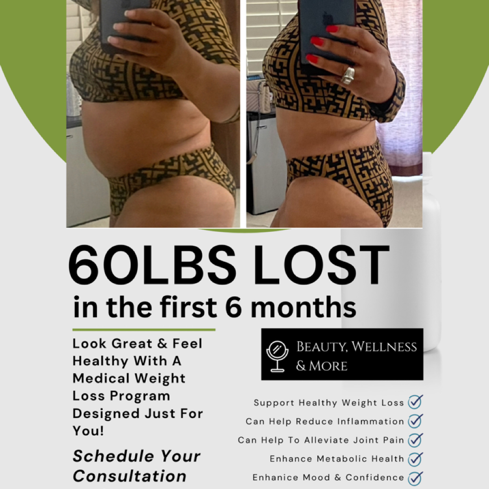 Weight Loss & Metabolic Wellness Su at Beauty, Wellness & More in Los Angeles, CA