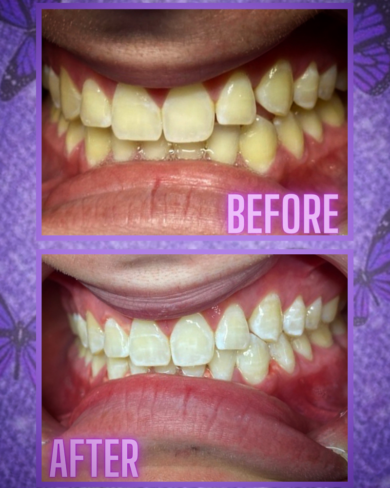 1 Hour (Double Application)