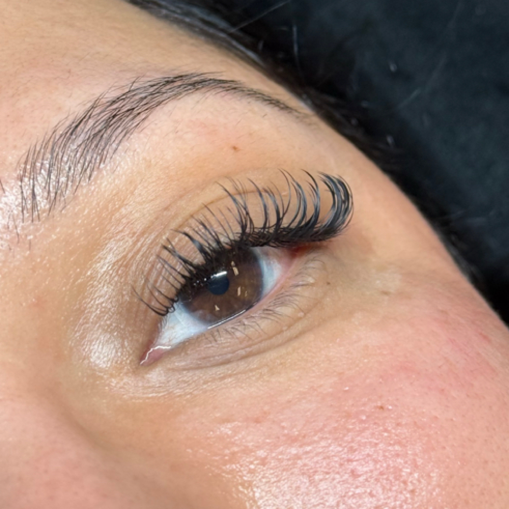 Classic Fill at KB Esthetics in Lubbock, TX