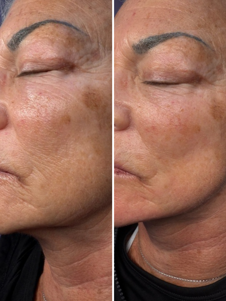 Face Sculpting
