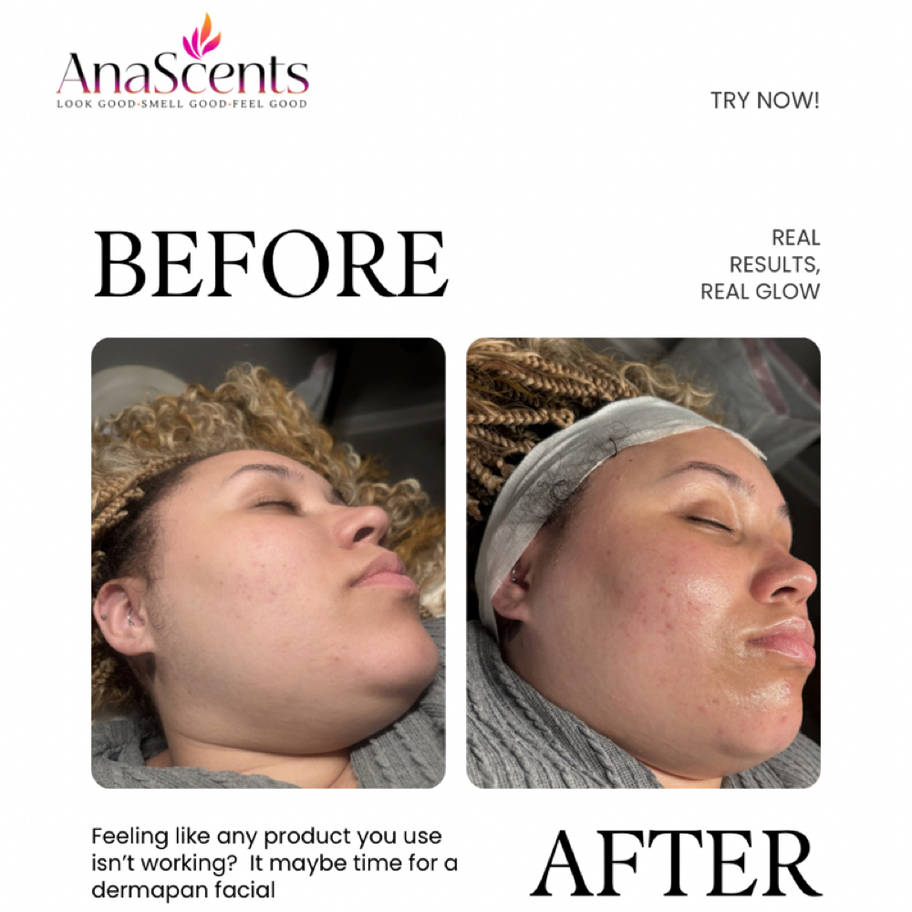 2 Dermaplan Sessions at Reona Spa in Gretna, LA