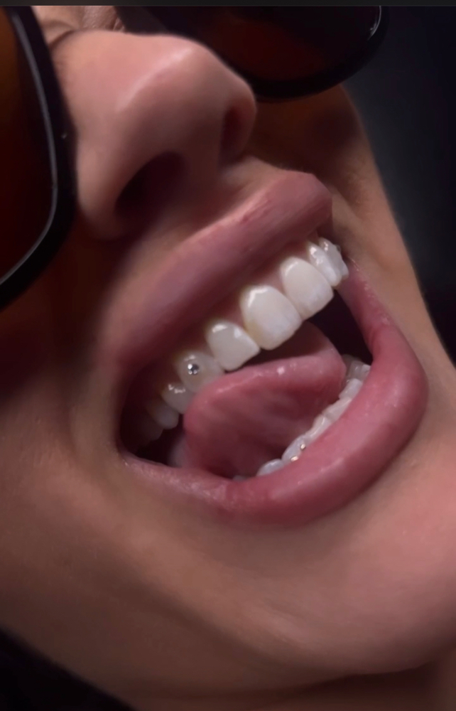 2 Diamond Tooth Gems Promo