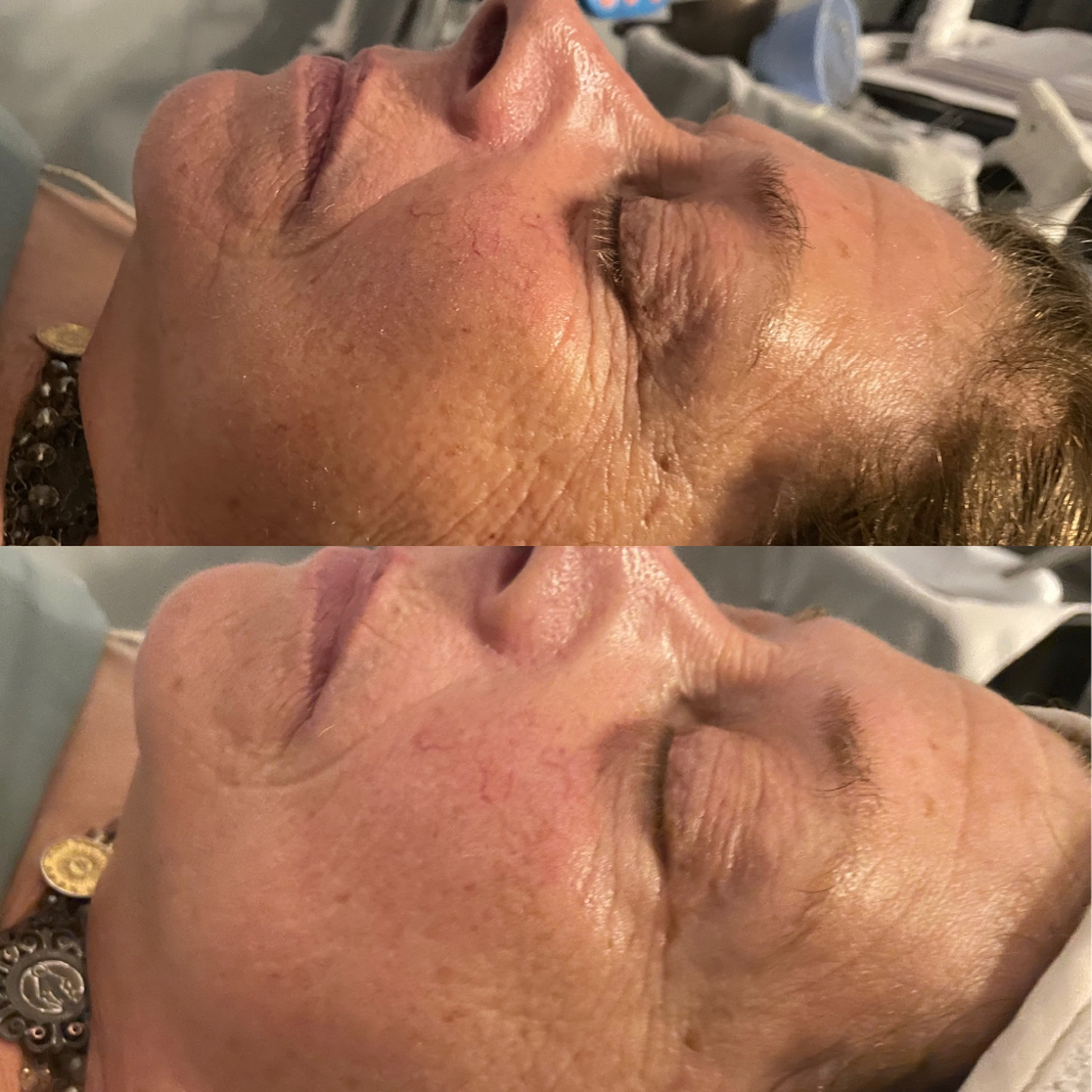 Prescriptive Facial