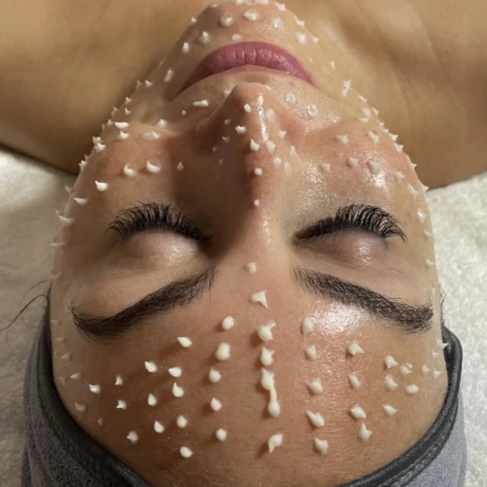 Cell Story " Pro-Treatment " at CITYSKIN in Southaven, MS