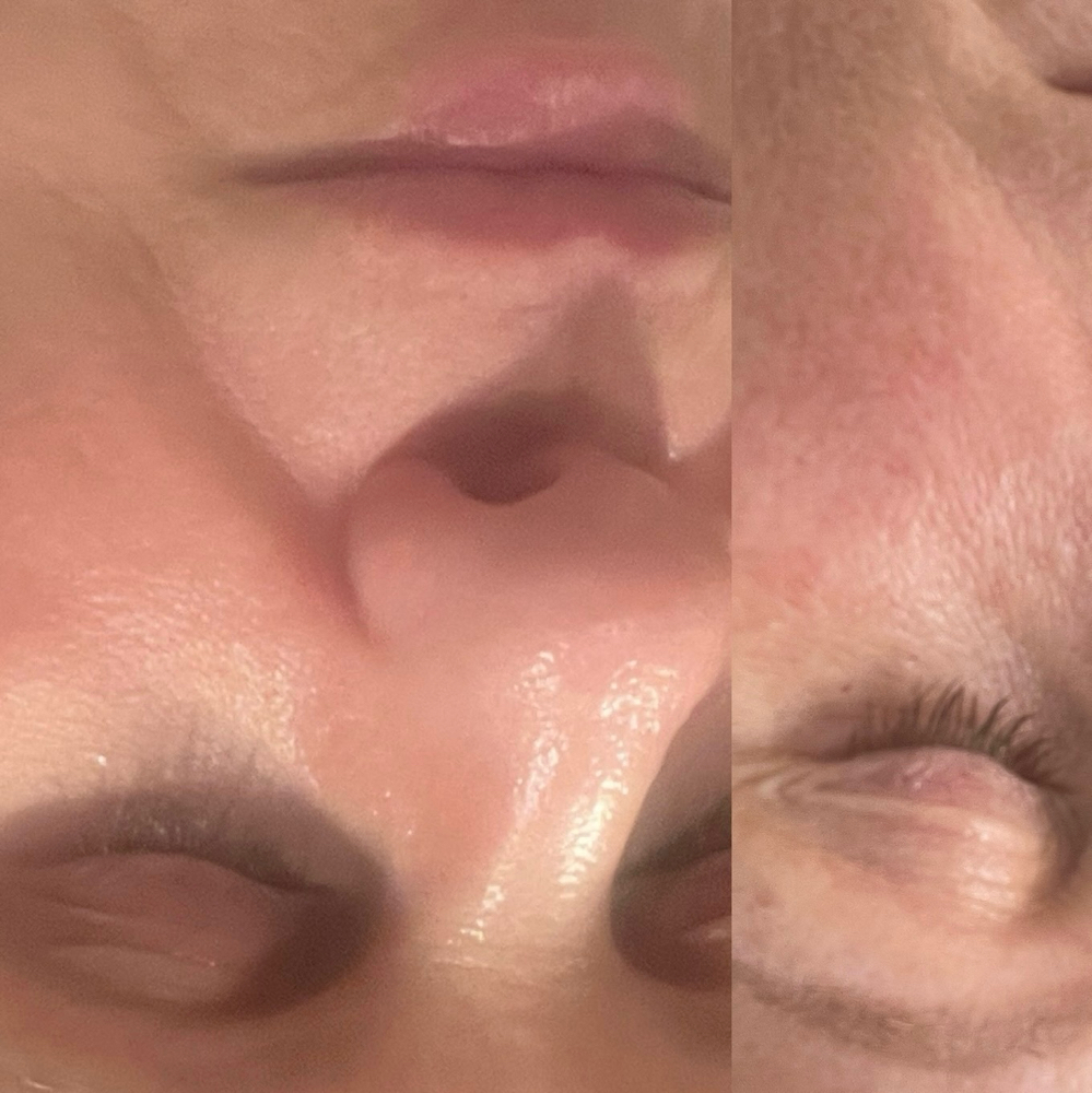 Luminfusion Glow Facial