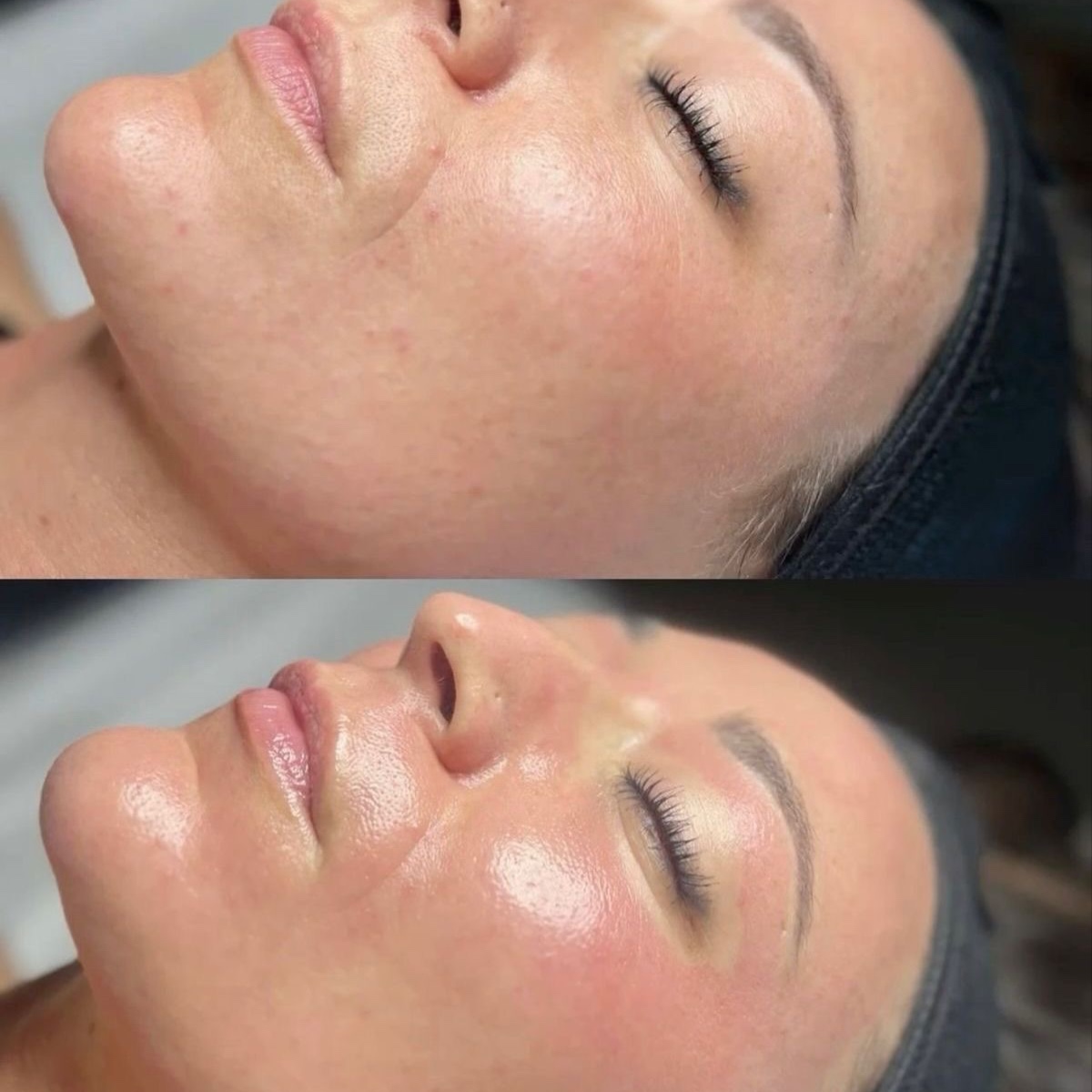 Resurfacing Ritual at Xo Nail Salon in Watseka, IL