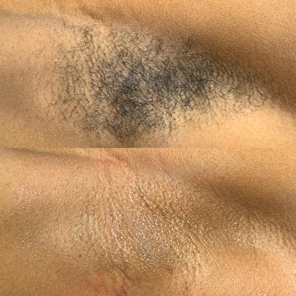 UNDERARM WAX