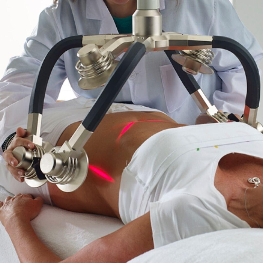 1 Laser Fat Reduction Session
