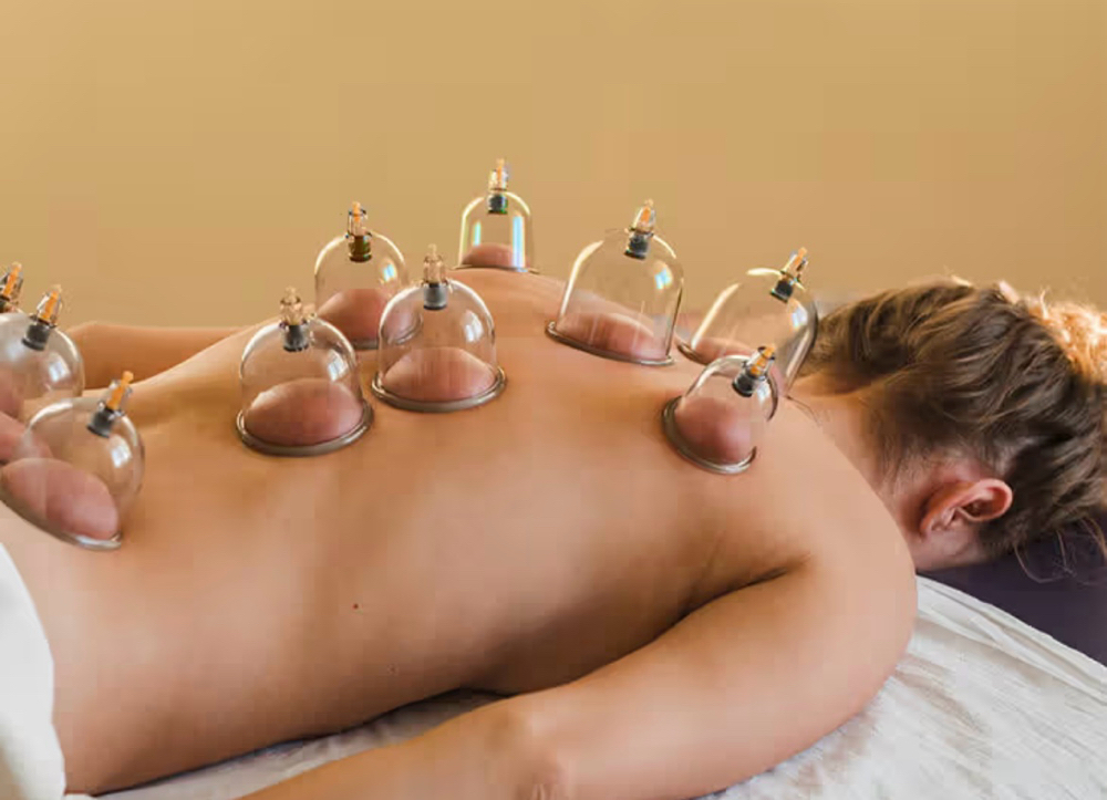 Cupping Adds On