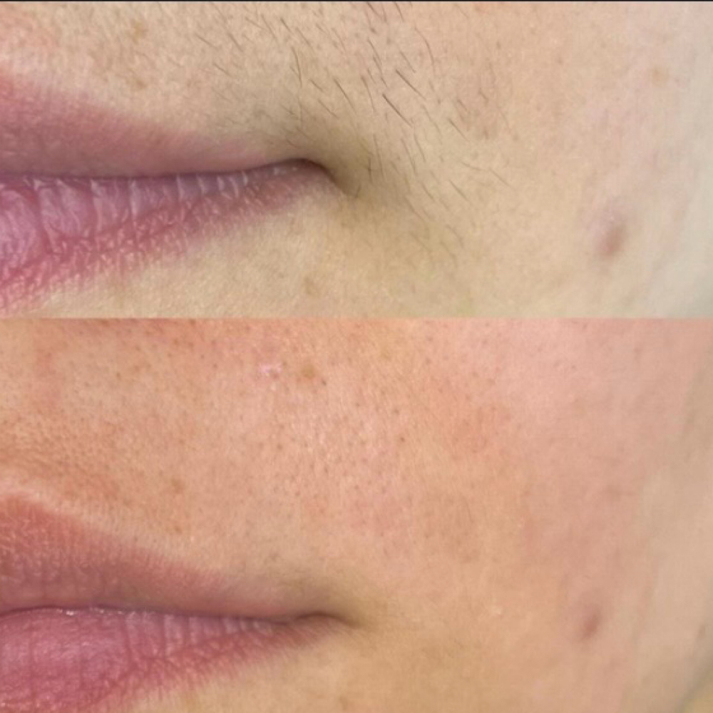 Face Waxing at Nouvèl Beauty Collective in New London, CT