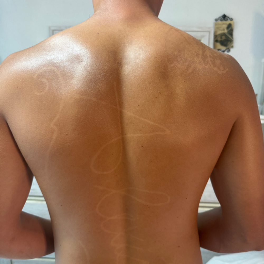 Back Facial at Hydra Skyn in Los Angeles, CA