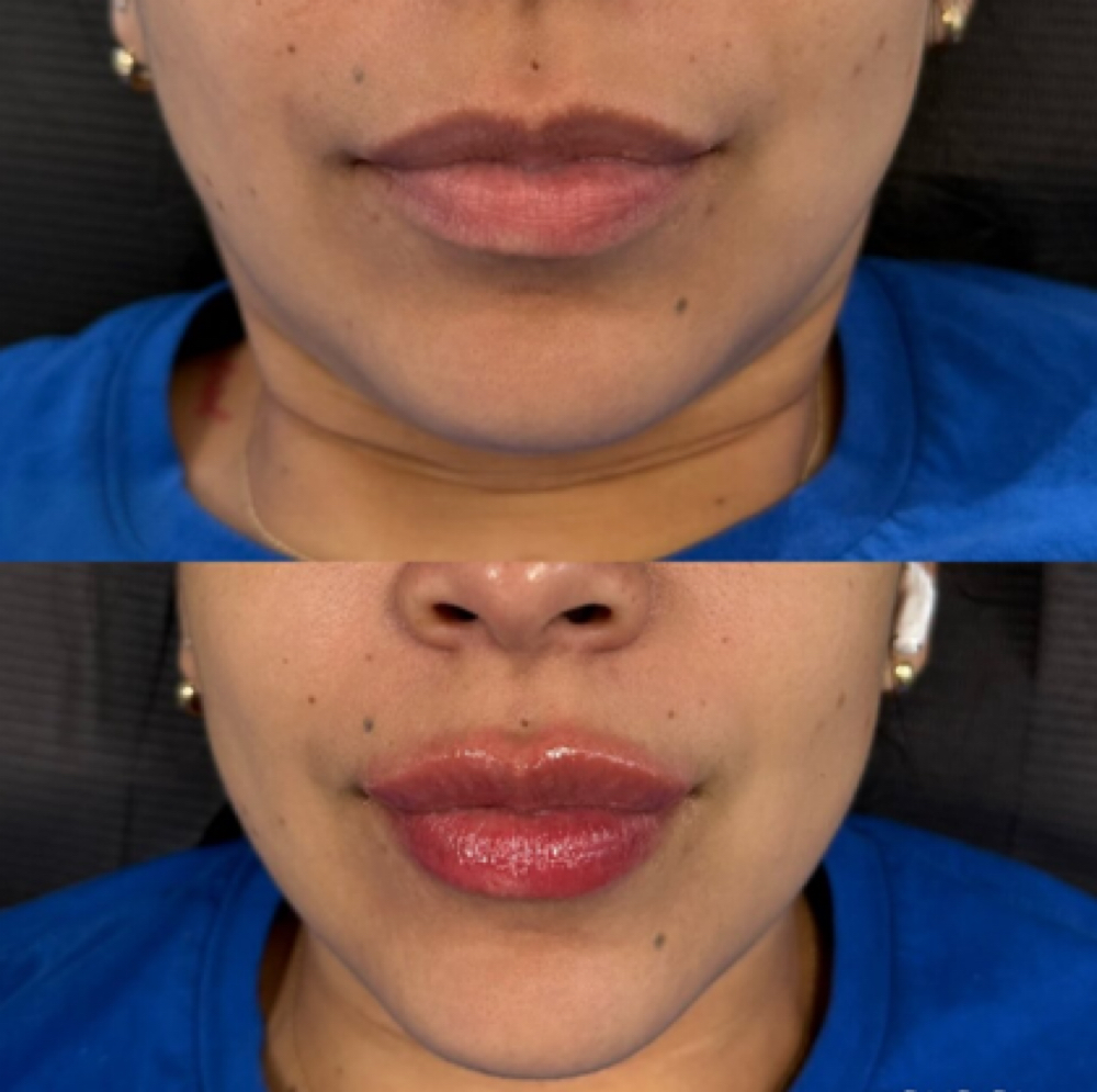 Russian/Dollfaced 1.5ML at Beautique J in Dorchester, MA