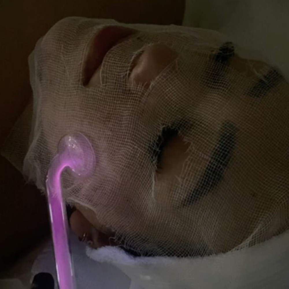 Add on - High frequency at Esthetics by Kaiya in Bedford, NH