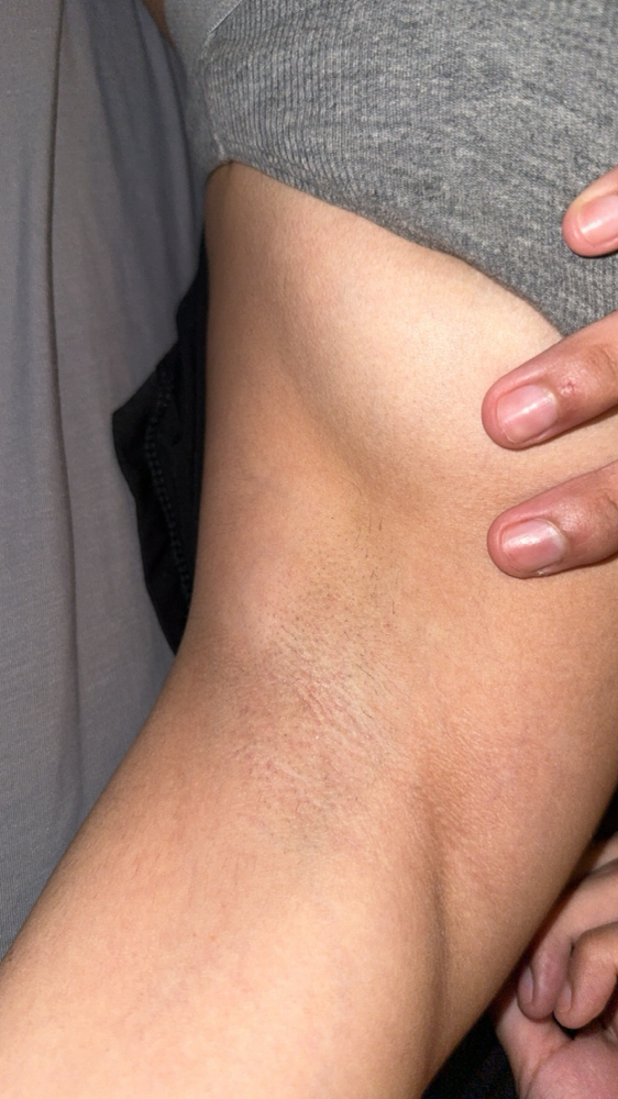 Underarm Wax at Radiant Touch Esthetics in Mishiwaka, IN