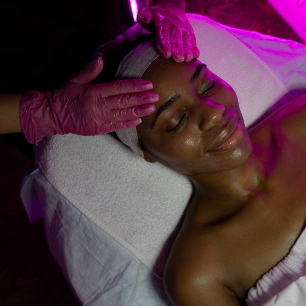 Chemical Peel Package (3 Sessions) at Maryna Skin Studio in Chicago, IL