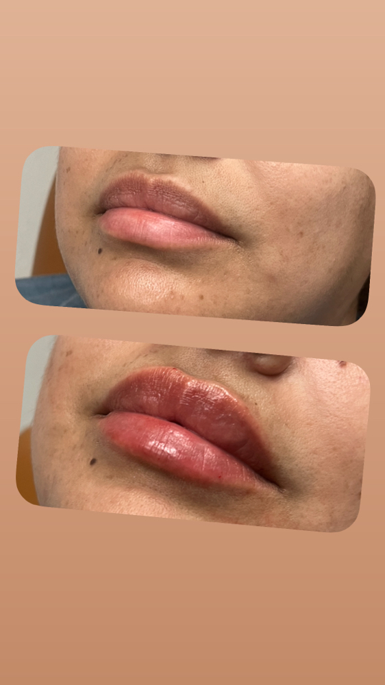 Lips With Celeste at Deja*Vu Tox And More in El Paso, TX