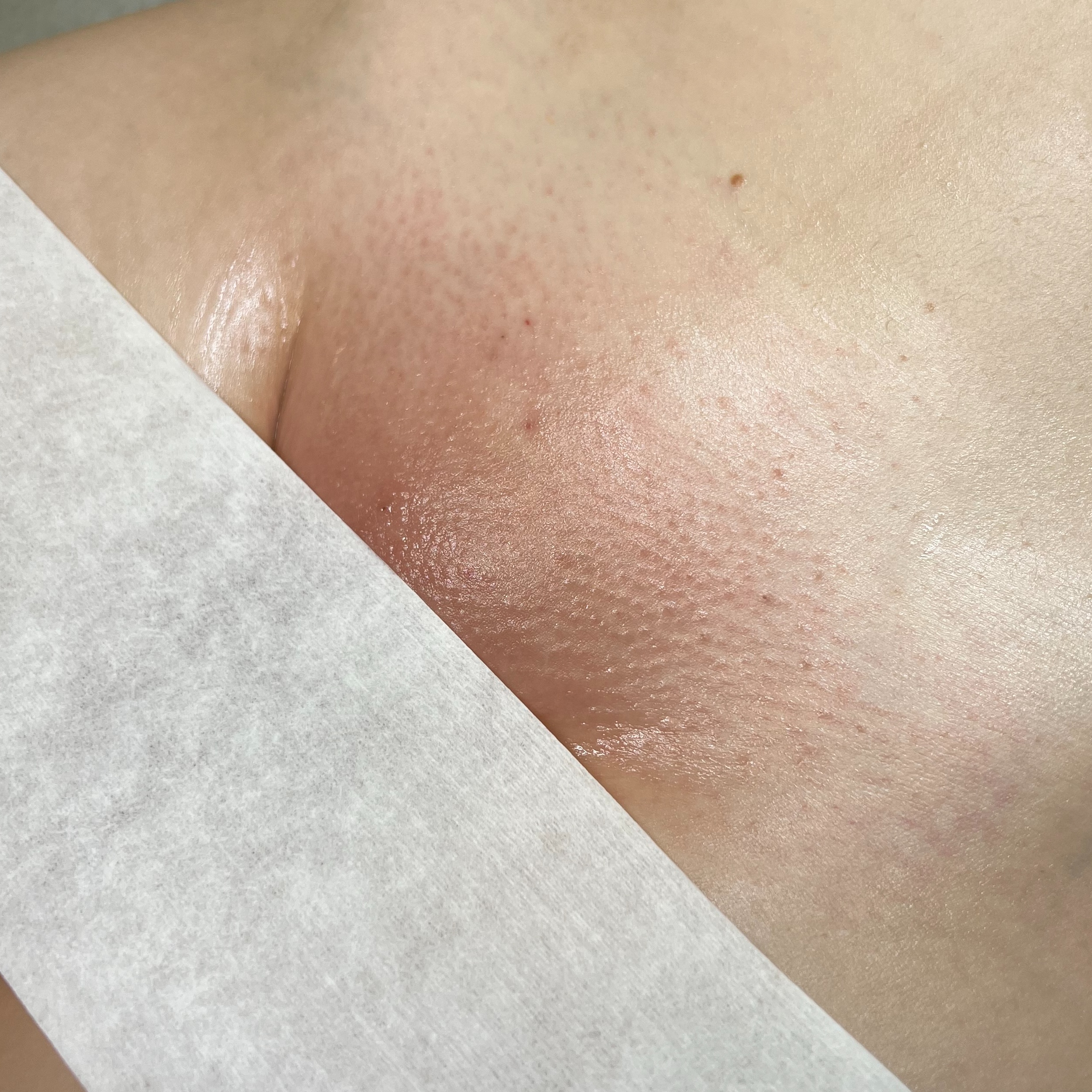 Extended Brazilian Wax