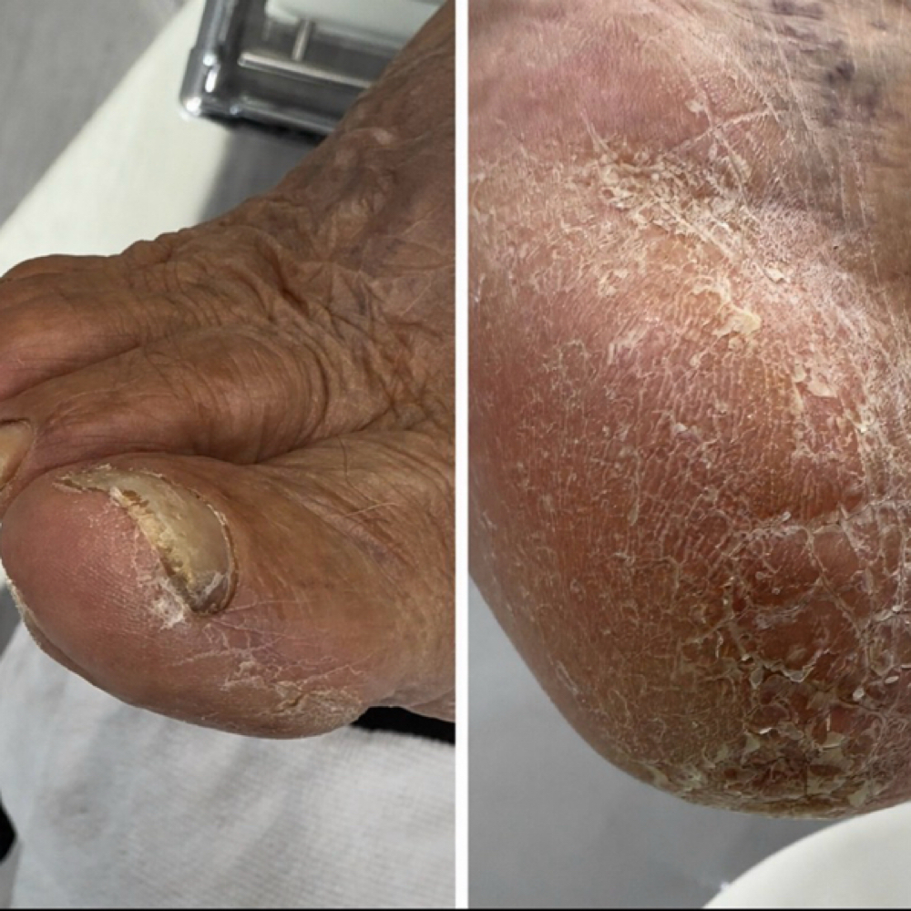 Level 2 - Moderate Foot Care | $140 at Rosy’s Mobile Nail Care in Lakeland, FL