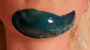 Chin
