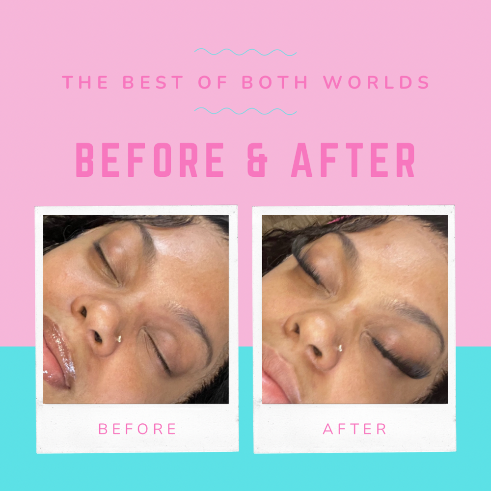 Eyelash Extension Removal