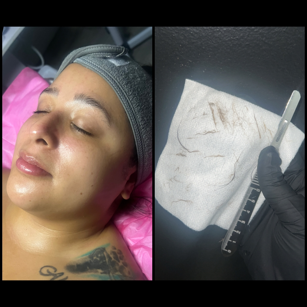 Deluxe Facial w/ Dermaplaning