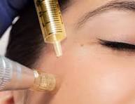 PRP Microneedling Package