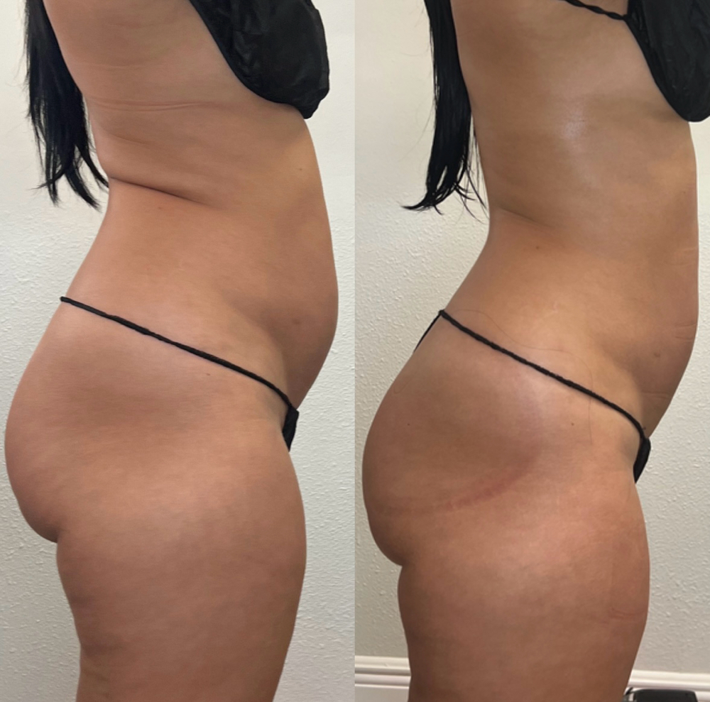 Full Body Detox