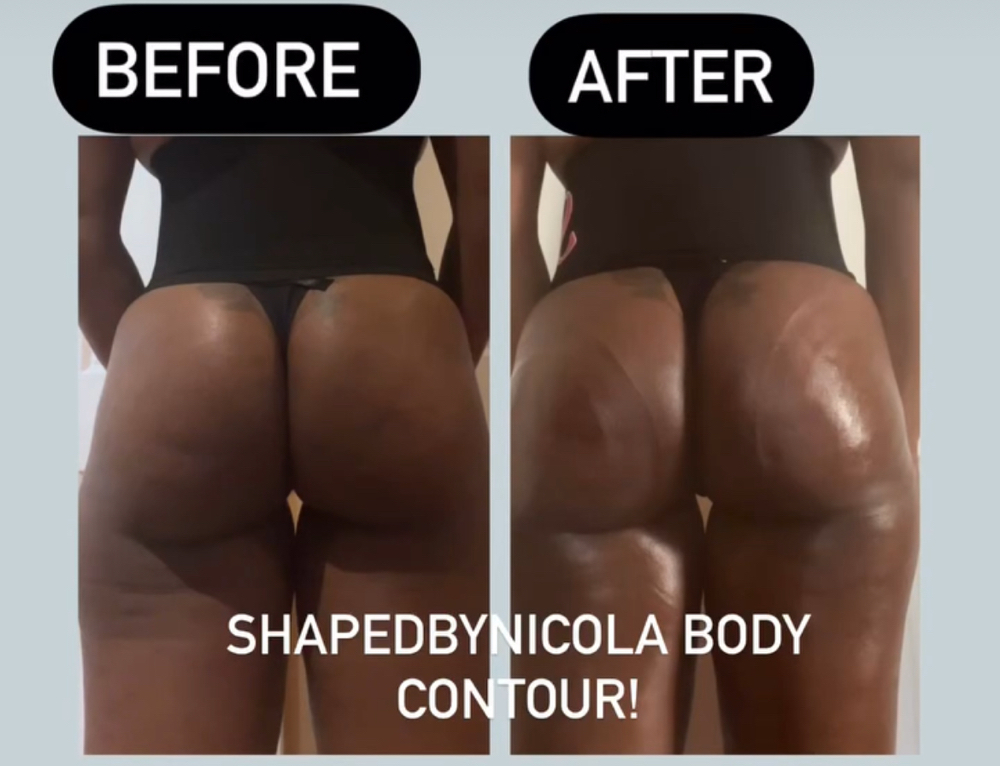 HIP DIP 2 SESSION * FILLING OUT OF at ShapedbyNicolabrowsandbody in Brooklyn, NY