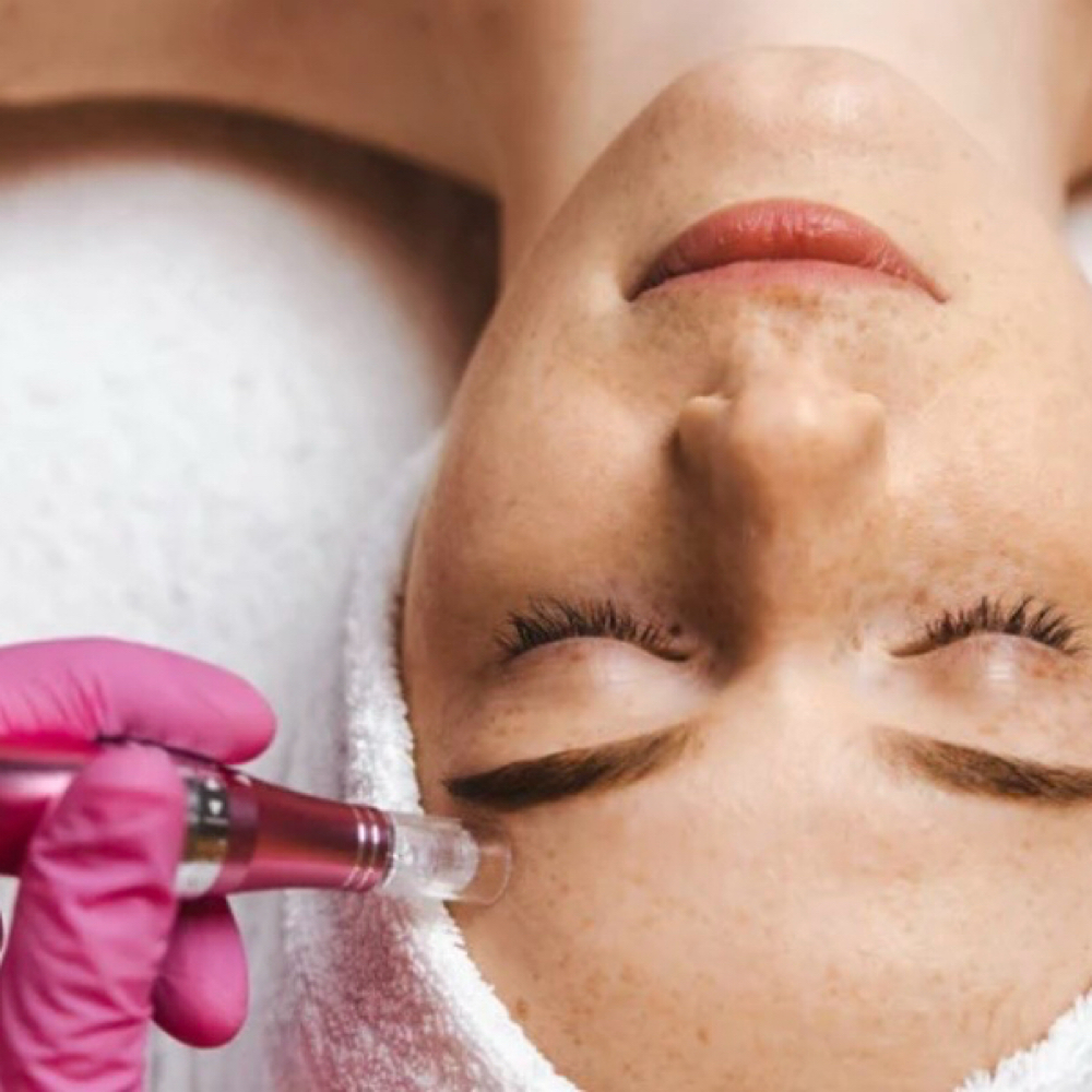 Micro/Nano-Needling Facial at Salon A'dora Esthetics in Longwood, FL