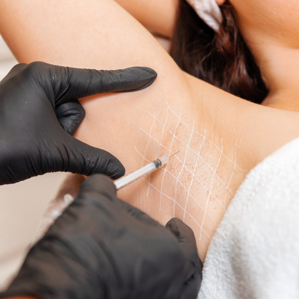 Hyperhidrosis Tox/Excessive Sweat at Injections by Leighanna in Clarksville, IN