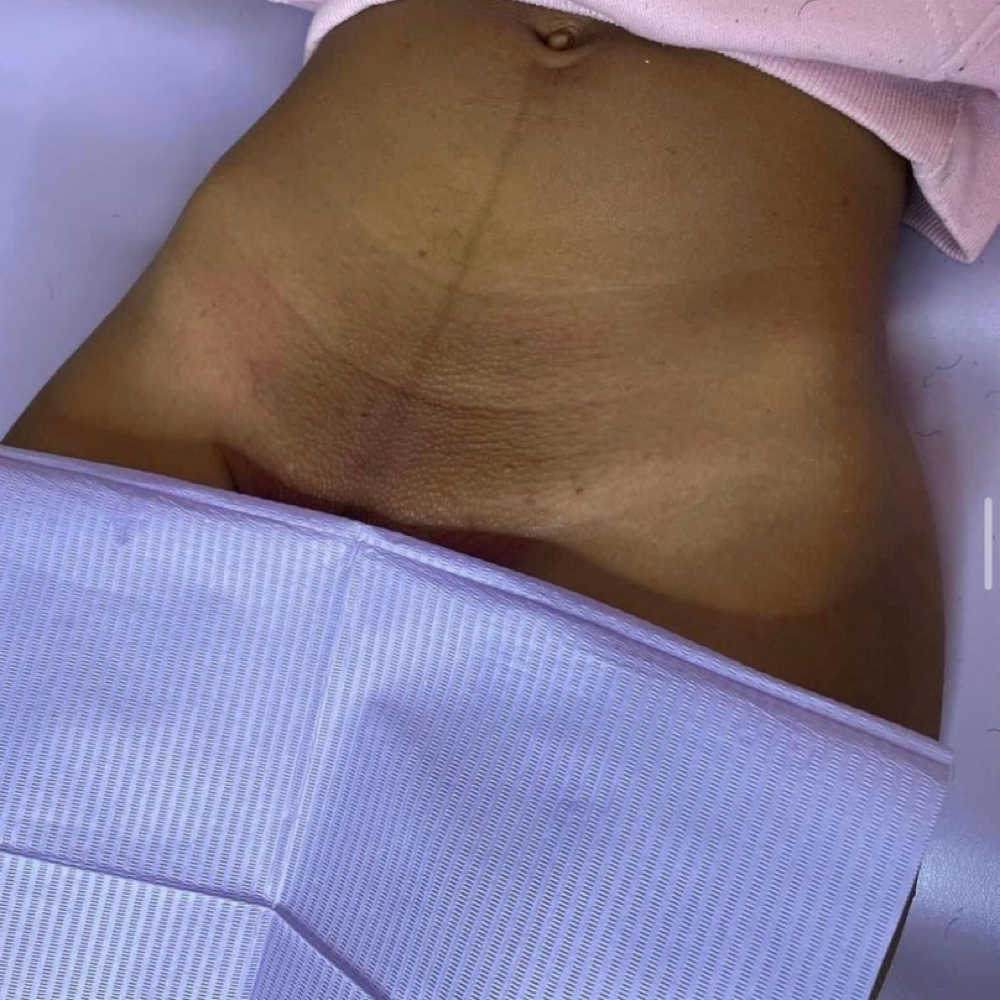 Brazilian Wax at The Wax Palace in Buffalo, NY