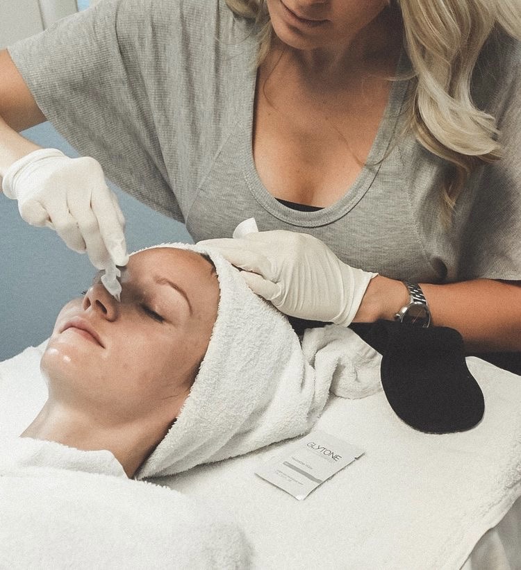 Chemical Peel Perfection Lift