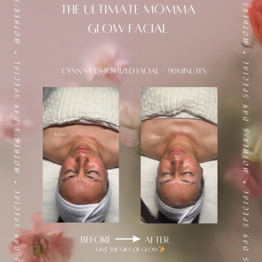 The Ultimate Momma Glow Facial at CYNNSBEAUTY in Tustin, CA