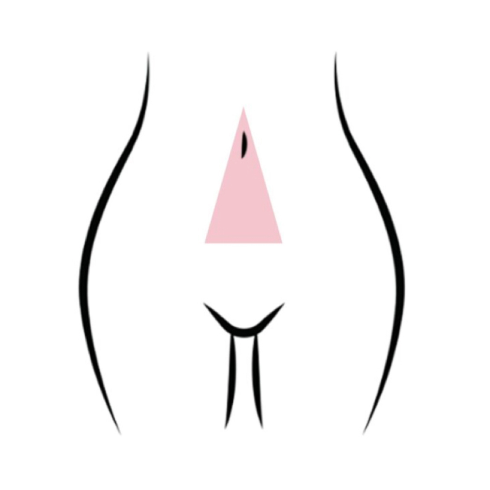 ✨ADD ON: Stomach Strip(W/Brazilian) at Gorgeous Darling Esthetics in Galesburg, IL