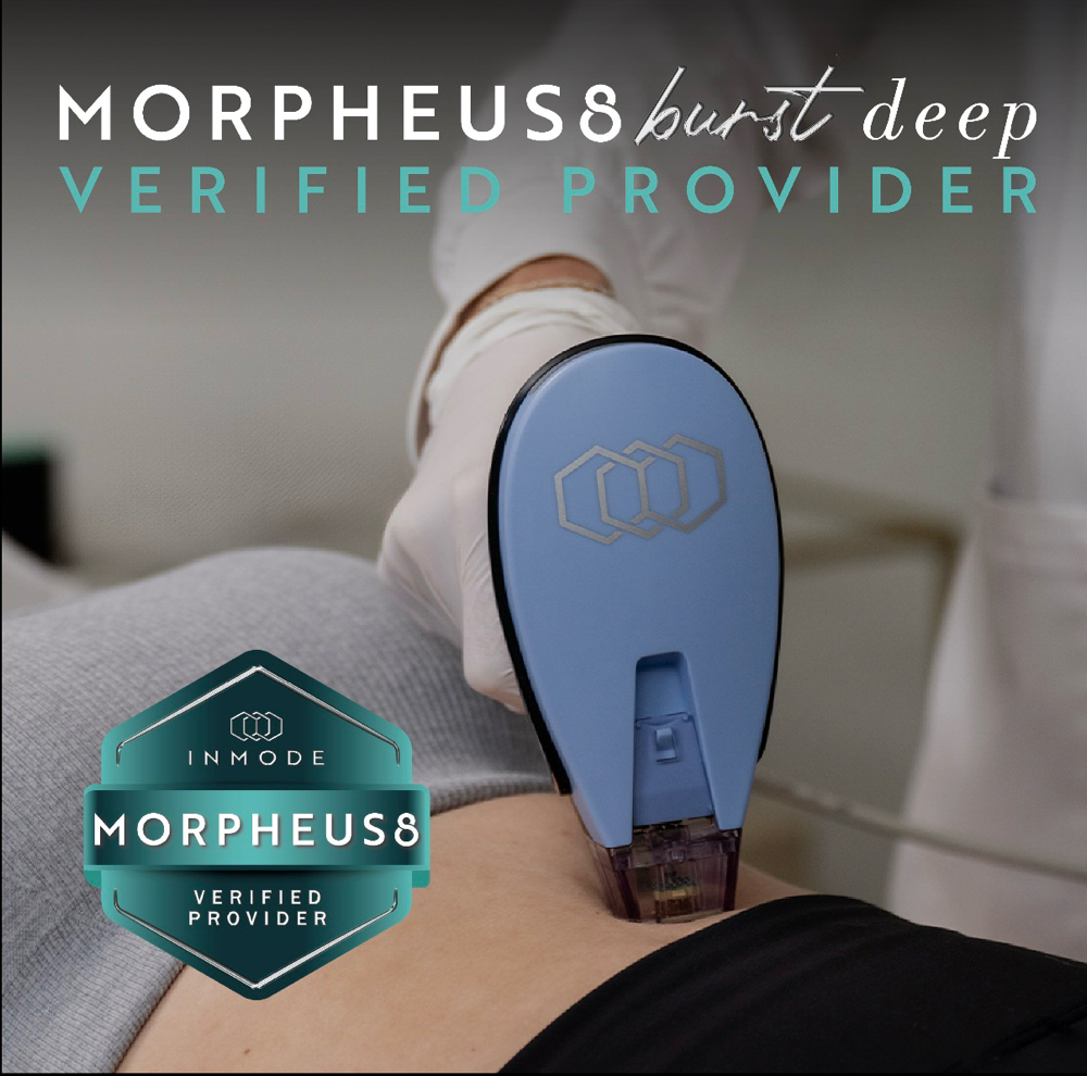 Morpheus8 Body – 3 Tx (Medium)