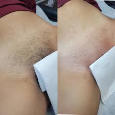 Full Bikini Waxing