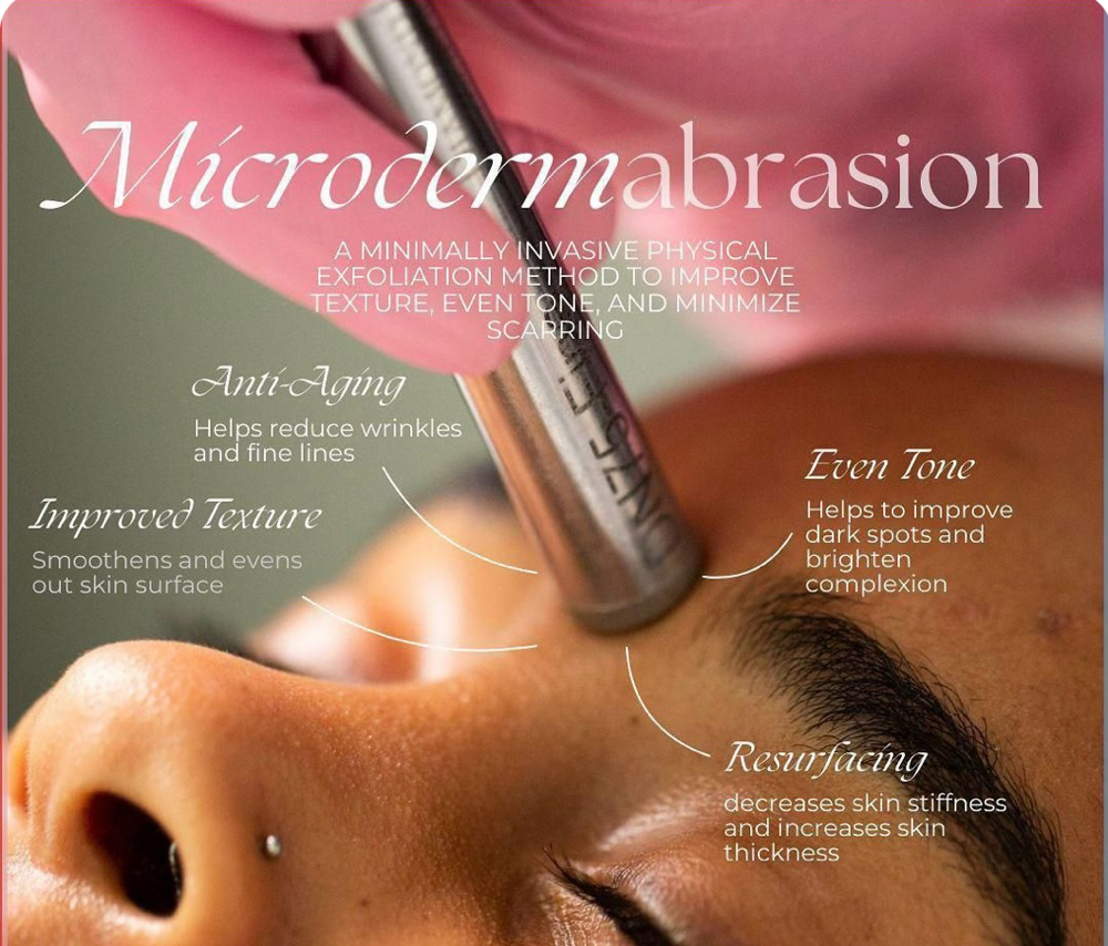 Diamond Microdermabrasion at Radiance & Kay the Beautician, LLC in Bulverde, TX