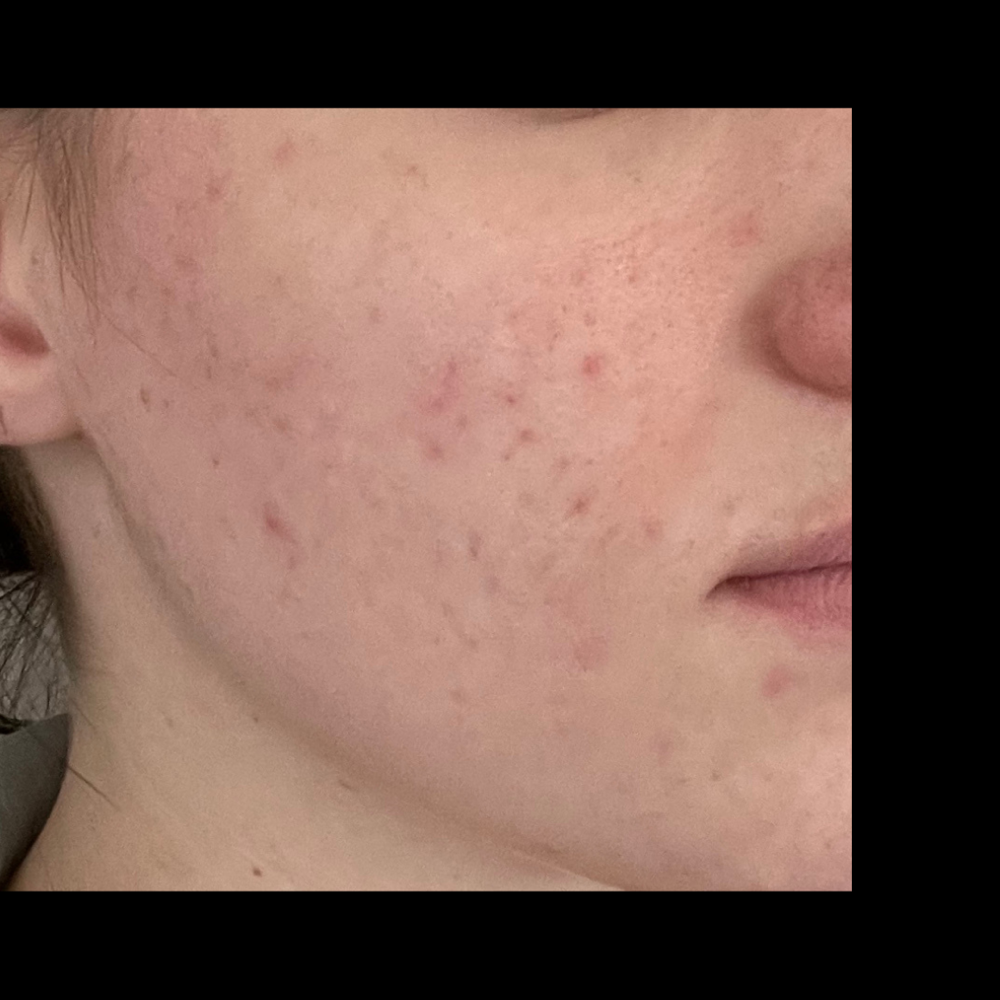 Cheek Wax