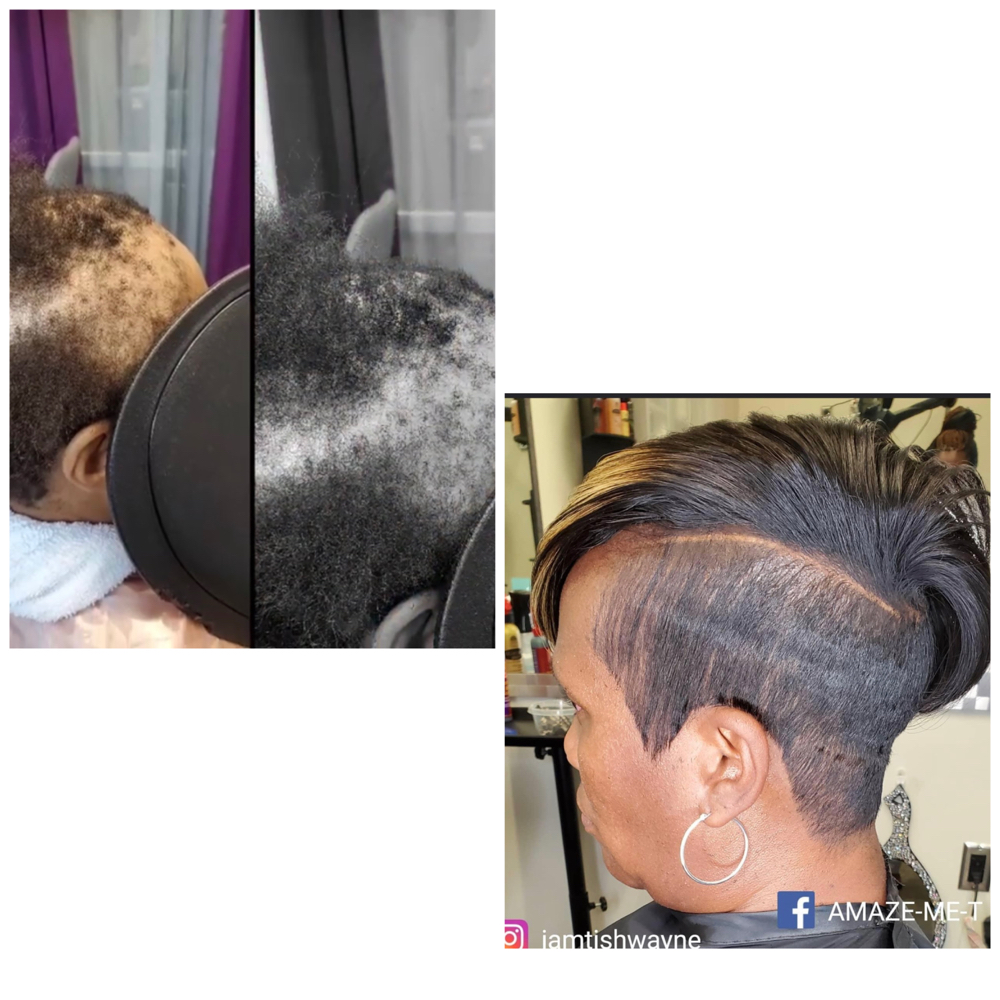 Traction Alopecia Quickweave/relaxe