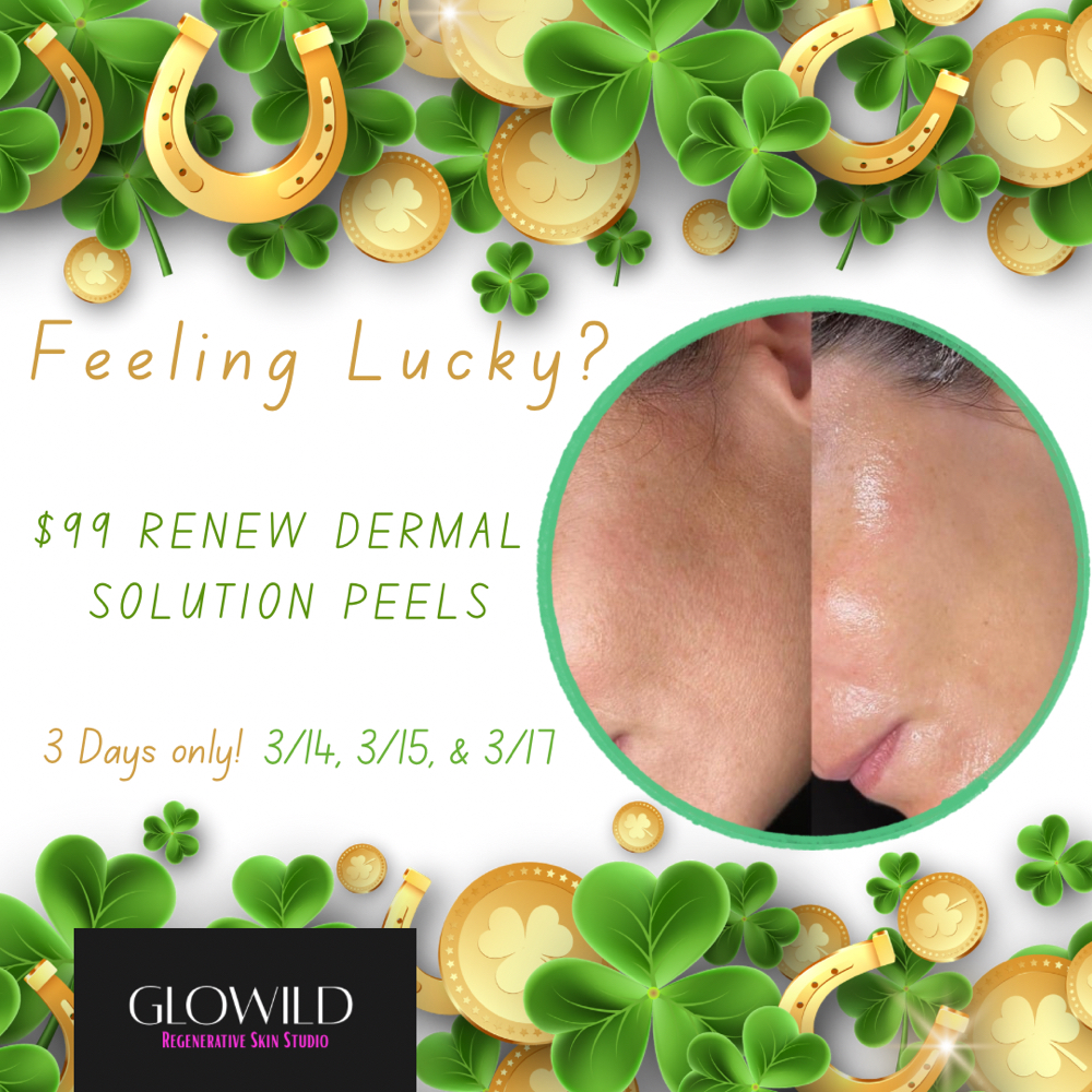 $99 RDS Peel - Luck Of The Irish at GloWild Regenerative Skin Studio in Cary, IL