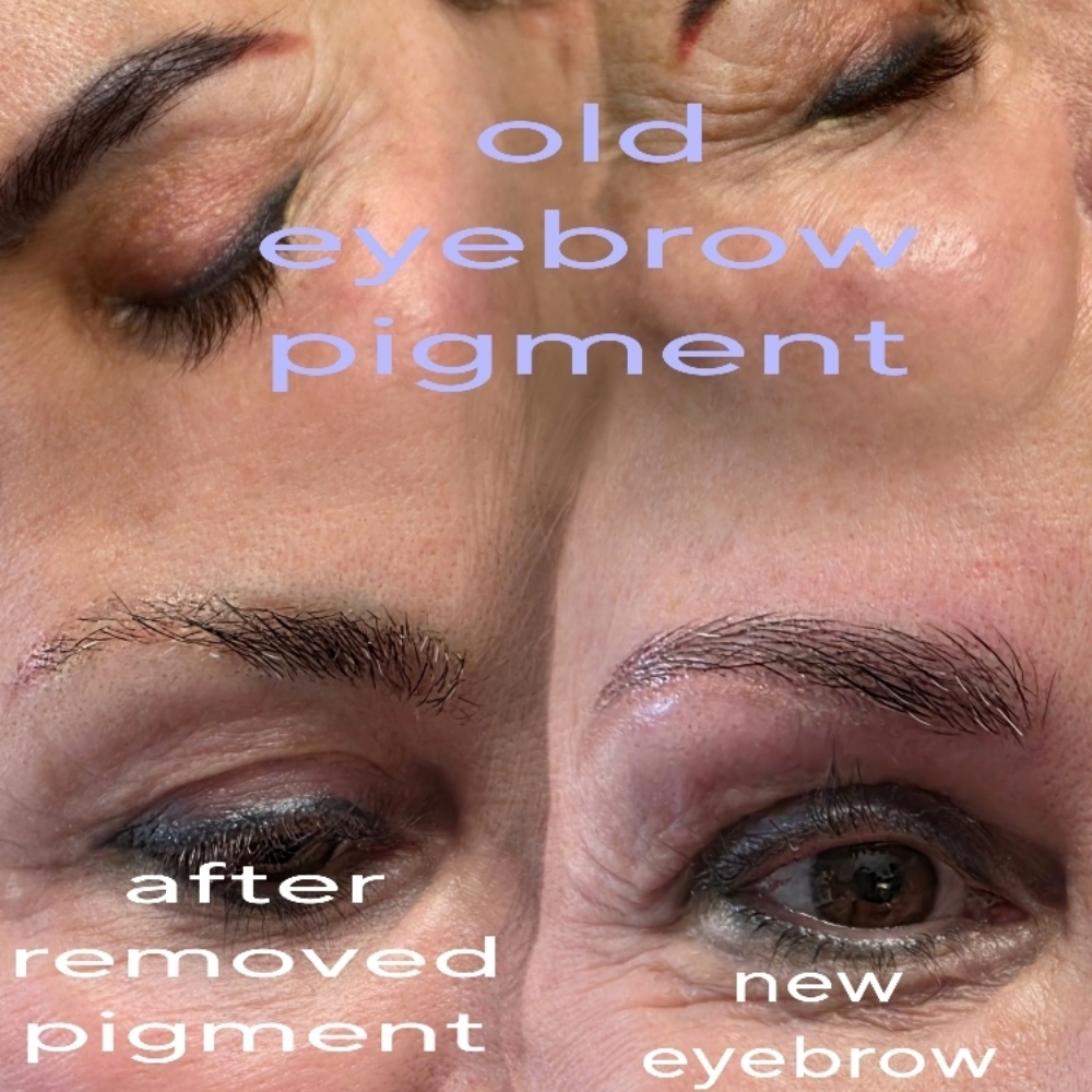 Eyebrow Tattoo Removal Laser at Tina Perma Beauty Spa in Old Saybrook, CT