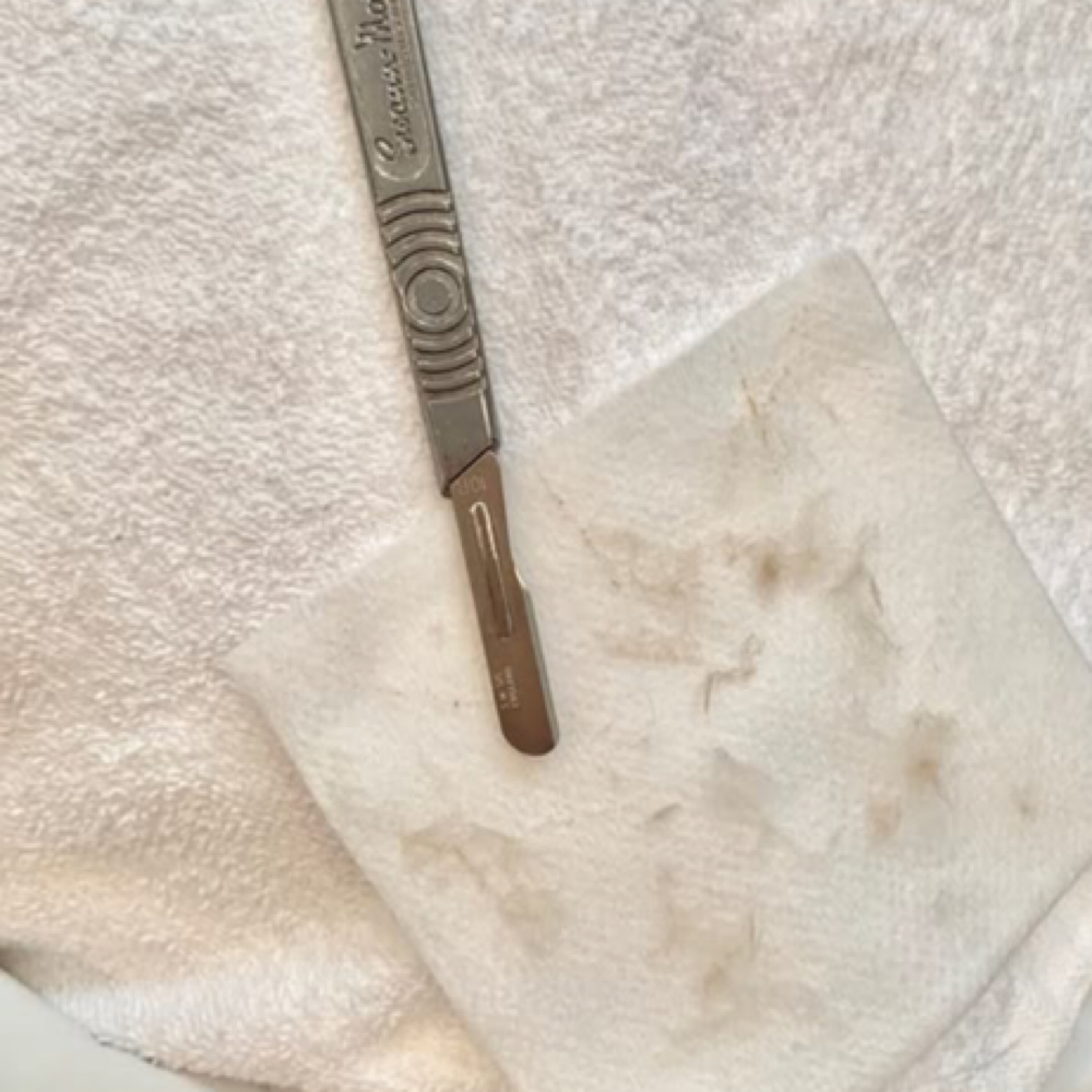 Dermaplaning Facial at LaRue & Co in Maryville, TN