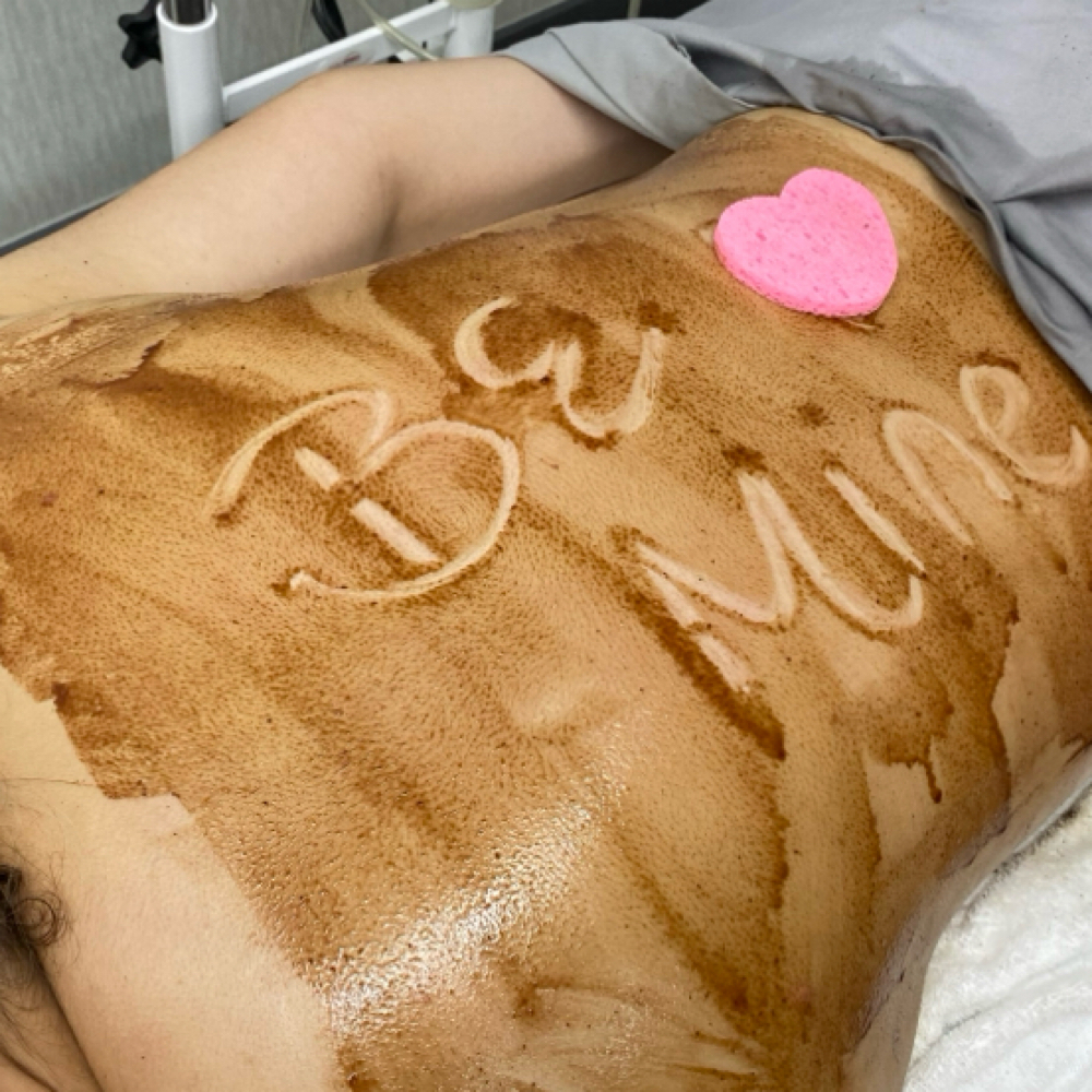 Back Facial at Theirieeallureaesthetics in Warner Robins, GA