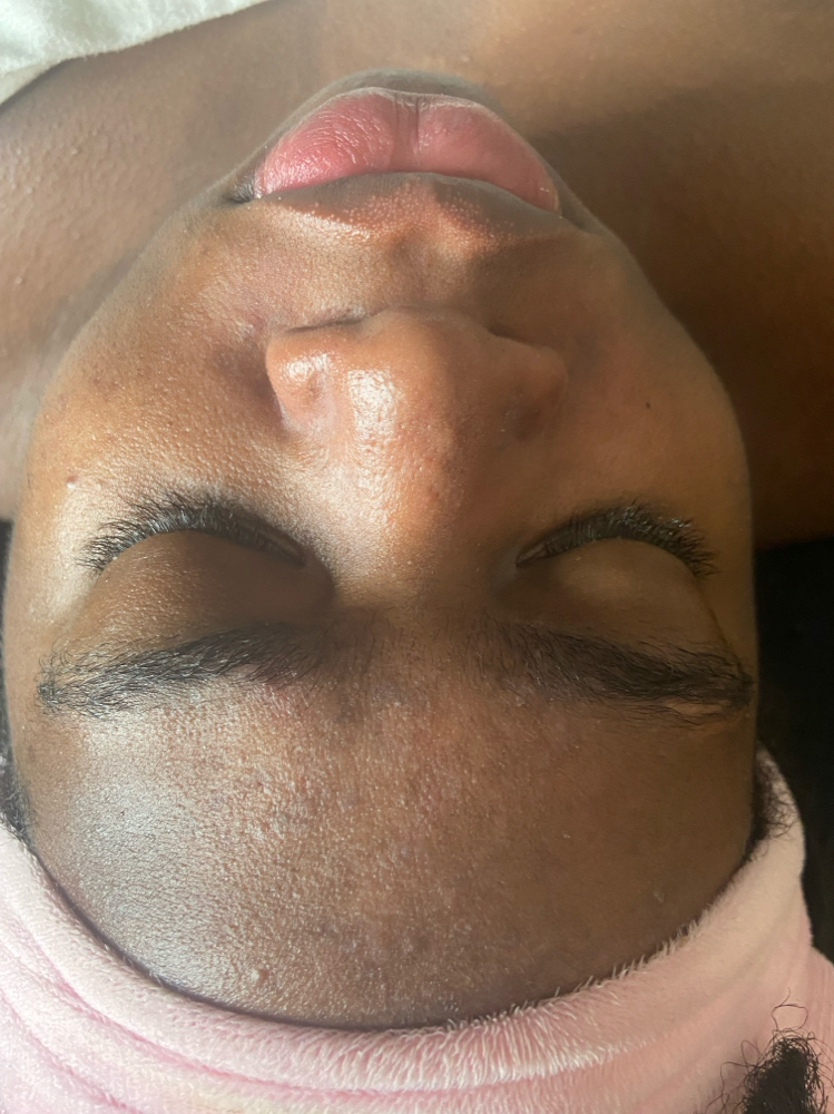 Teen Facial at Glow2Go in Cincinnati, OH